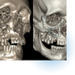 Facial Trauma
