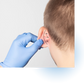 Otoplasty